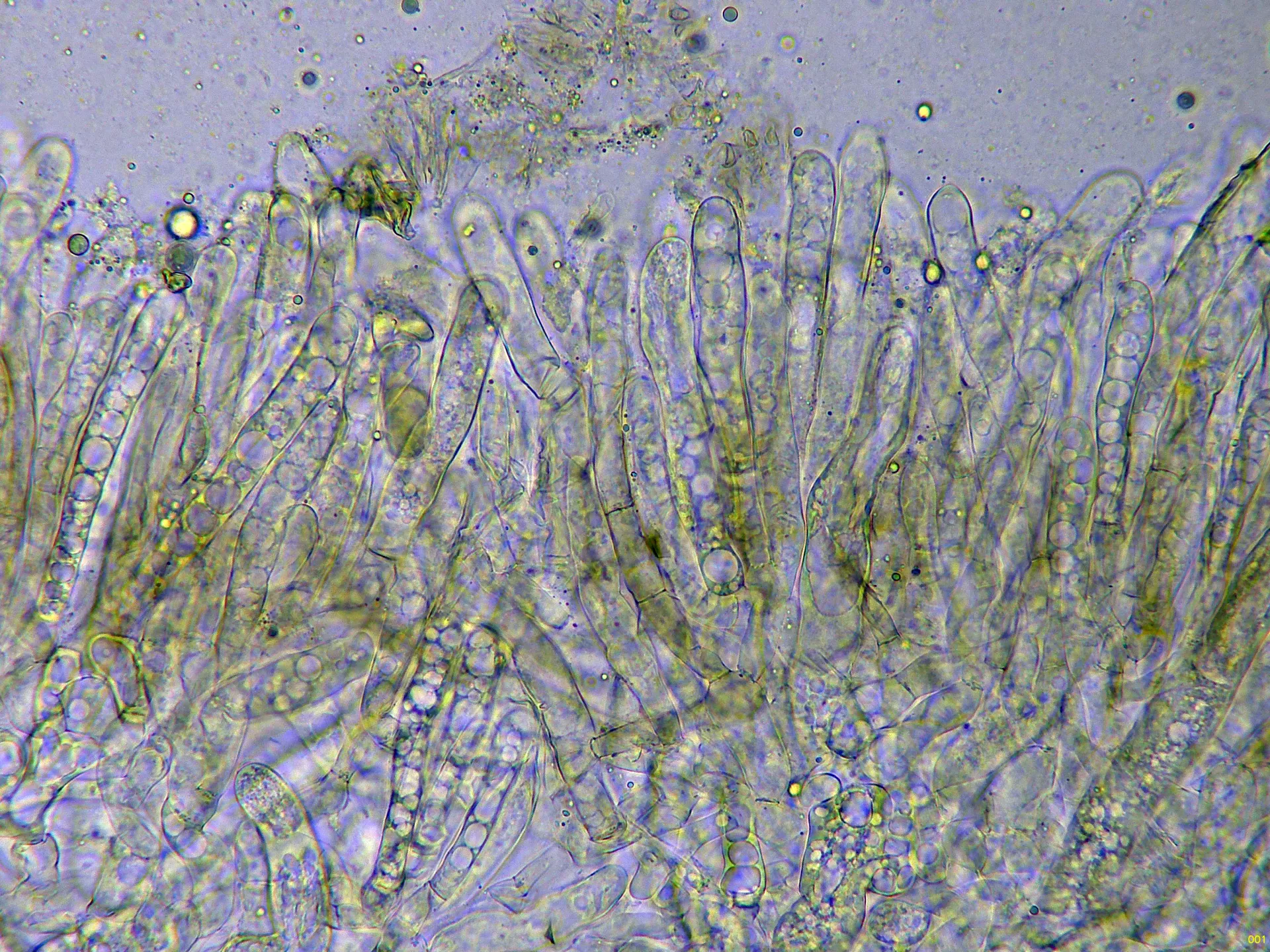 Microscopía de Morchella tridentina - 10 - Ascos joven x 400-001